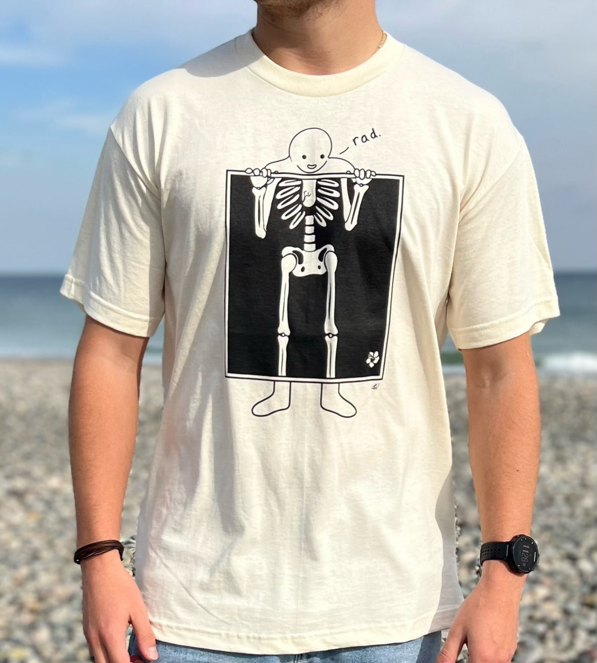 Tees